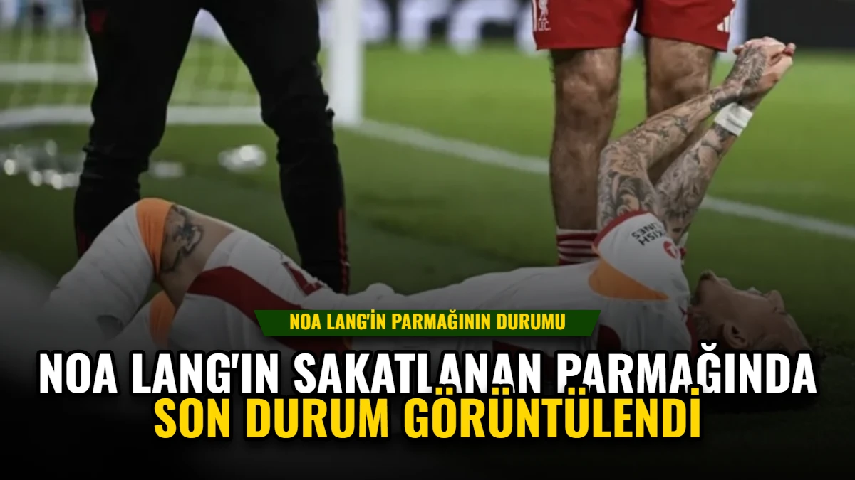 Noa Lang'ın Sakatlanan Parmağında Son Durum Görüntülendi
